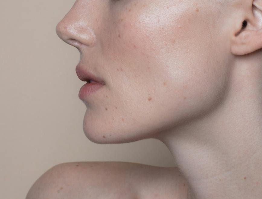 face person human skin freckle