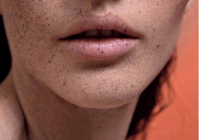 face person human freckle skin